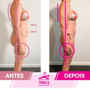 ANTES&DEPOIS_POLIANA#3EDITADO