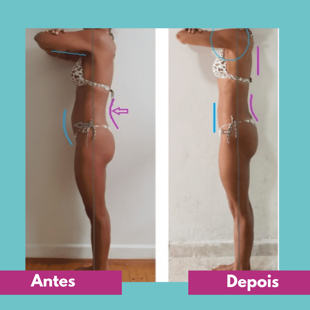 Antes e depois (11)