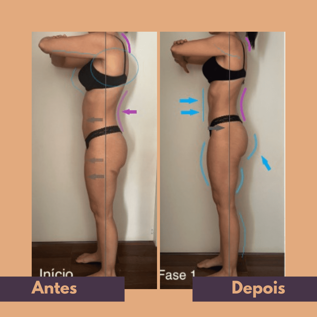 Antes e depois (13)