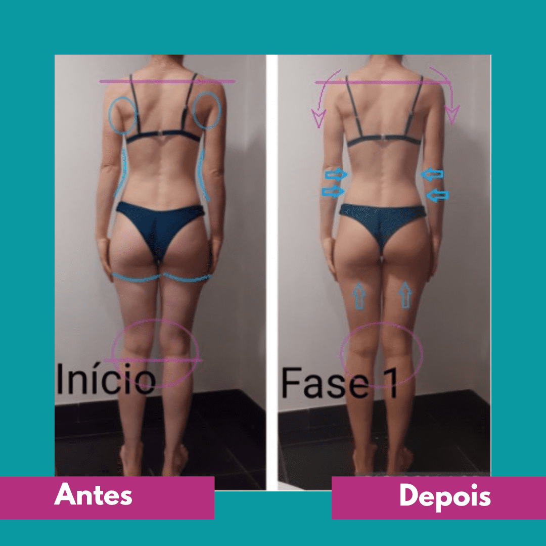 Antes e depois (14)