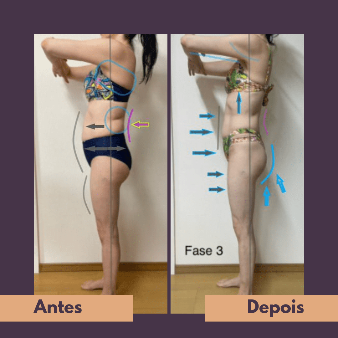 Antes e depois (15)
