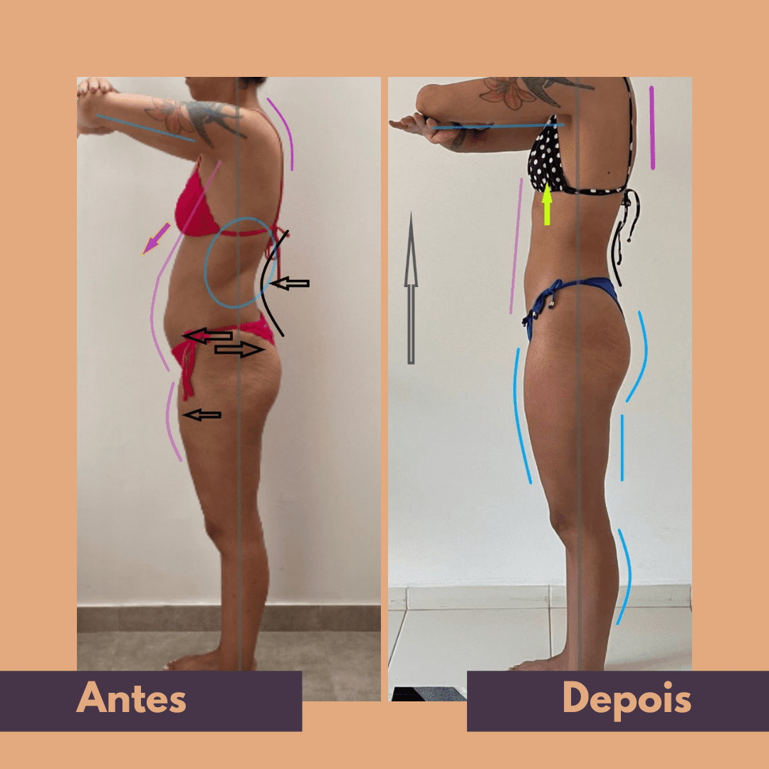 Antes e depois (17)