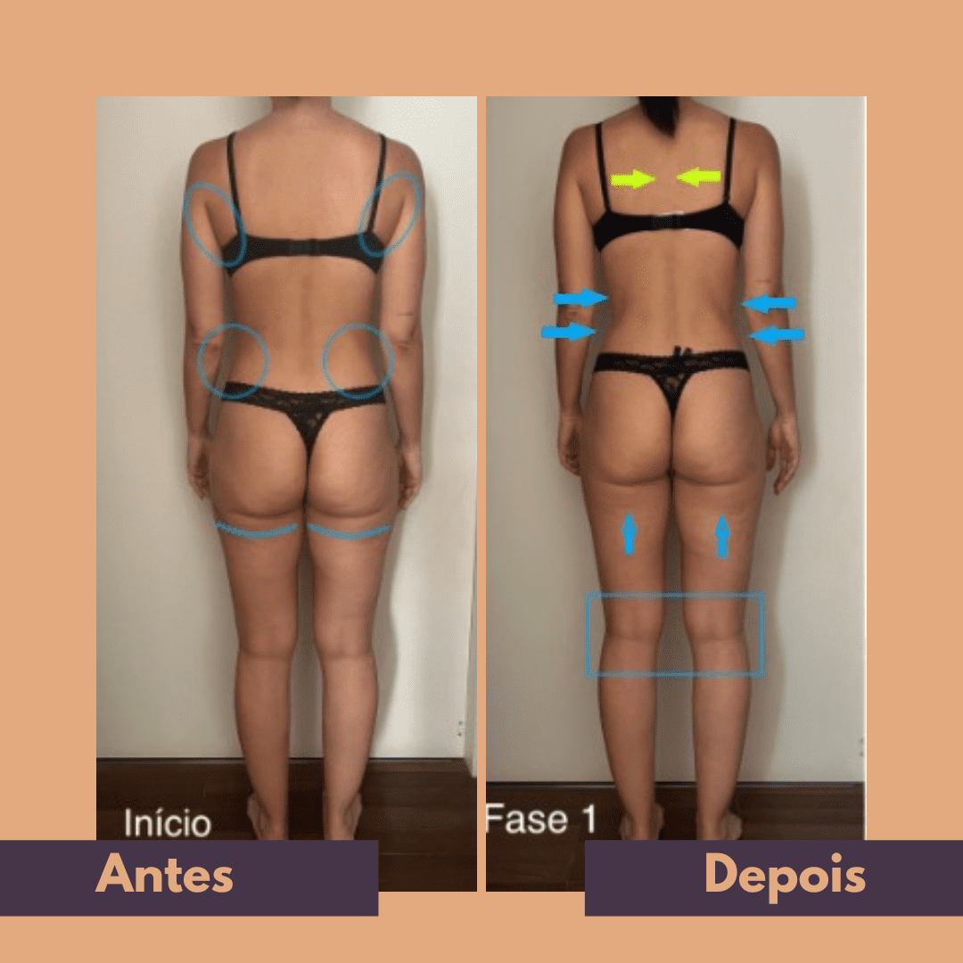 Antes e depois (18)