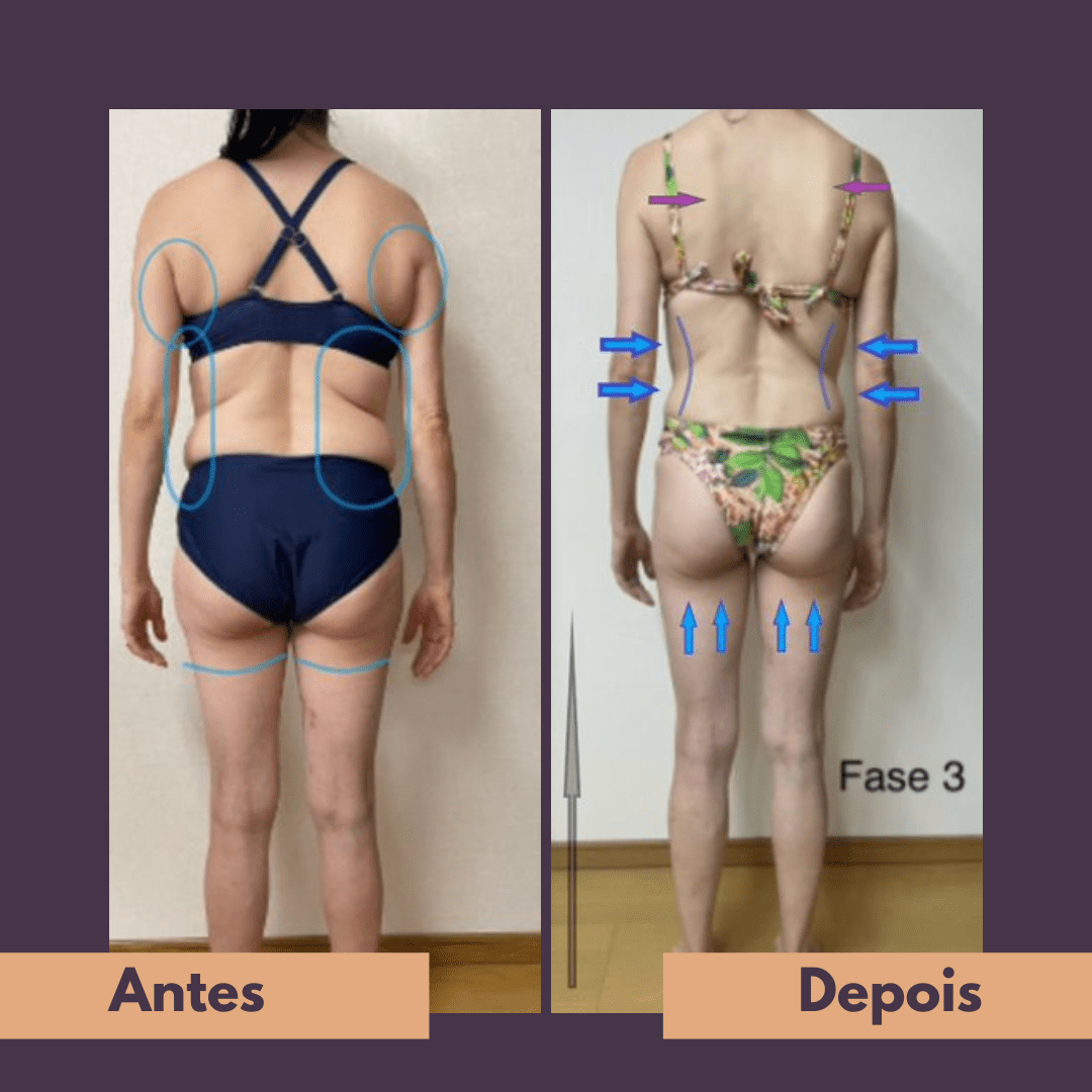 Antes e depois (19)