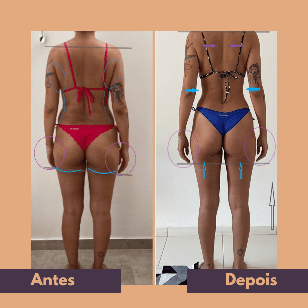 Antes e depois (20)