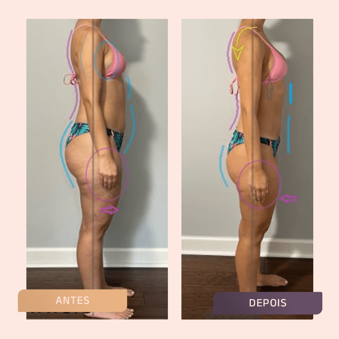 Antes e depois (23)