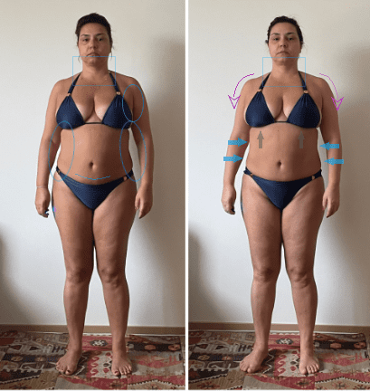Antes e depois (26)