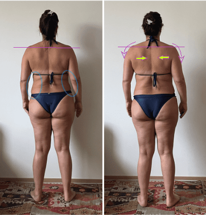 Antes e depois (27)