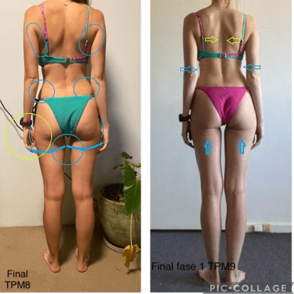 Antes e depois (31)