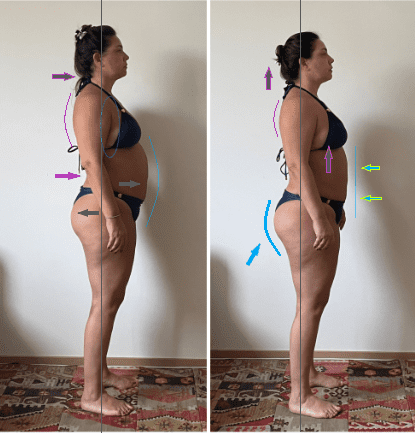 Antes e depois (34)