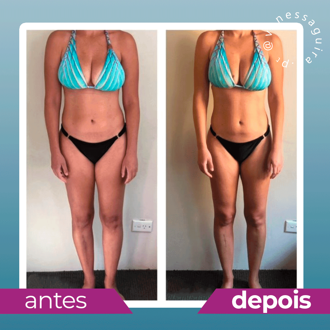 Antes e depois (35)
