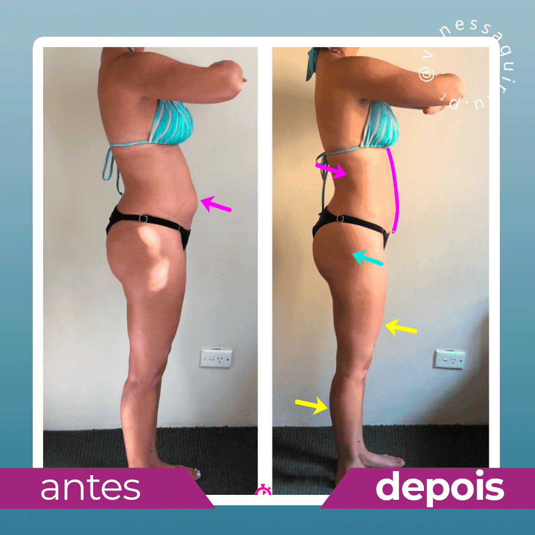 Antes e depois (36)
