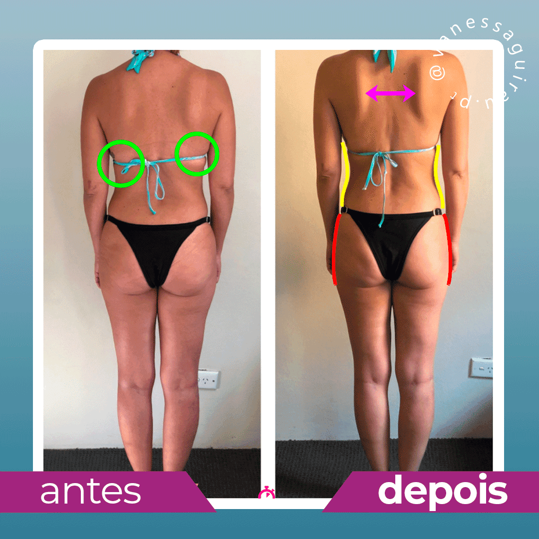 Antes e depois (37)