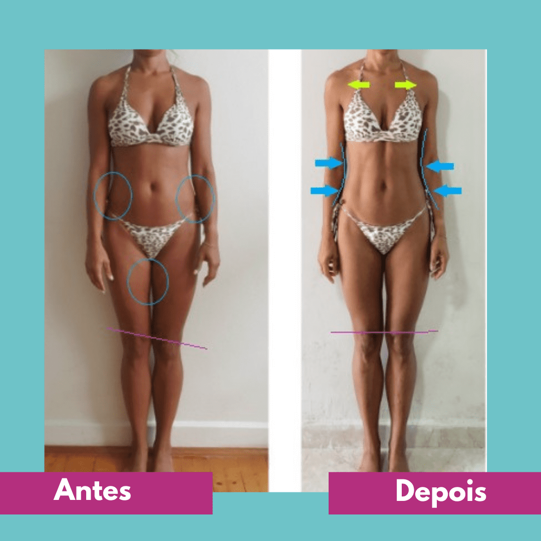 Antes e depois (5)