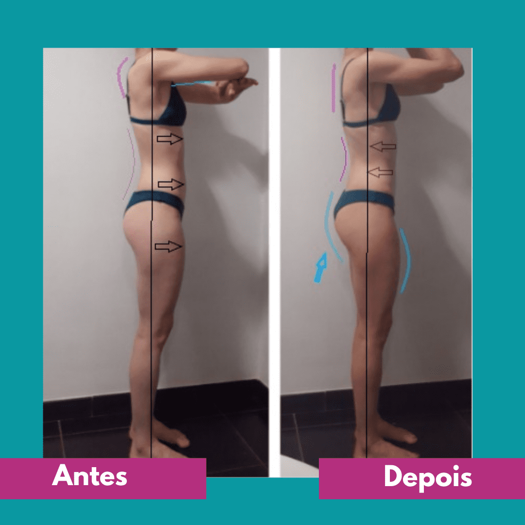 Antes e depois (8)