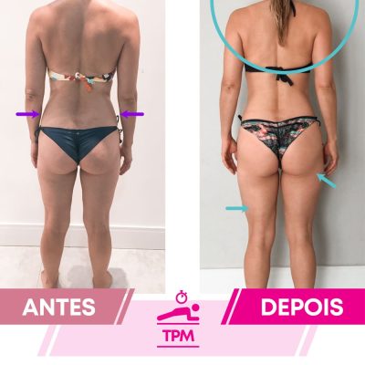 ANTES&DEPOIS_SORAYA#3